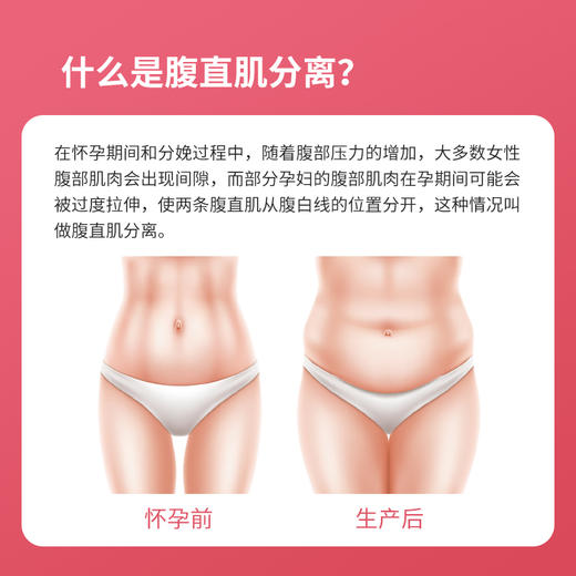 腹直肌修复套餐/10次（基础版） 商品图1