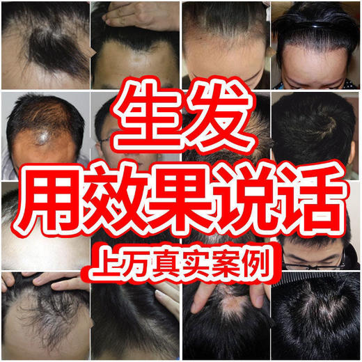 【南京同仁堂】生姜防脱洗发水生发增发密发固发控油变黑去屑止痒 商品图1