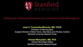 2020/Top2.内镜下鞍结节脑膜瘤手术切除