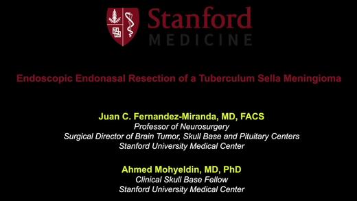 2020/Top2.内镜下鞍结节脑膜瘤手术切除 商品图0