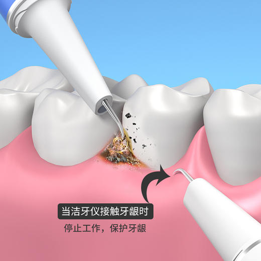 素诺可视化500w像素超声波洁牙仪家用去牙结石去除器洗牙齿牙石神器 商品图3