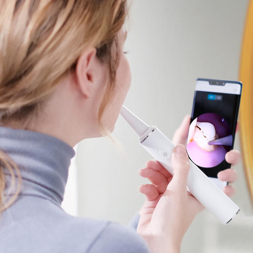 素诺可视化500w像素超声波洁牙仪家用去牙结石去除器洗牙齿牙石神器 商品图4