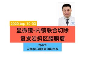 2020/Top03-显微镜-内镜联合复发岩斜区脑膜瘤切除术