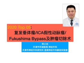 2020/Top05-复发垂体瘤 假性ICA动脉瘤FukushimaBypass