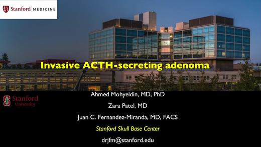 2020/Top7.内镜下侵袭性ACTH腺瘤切除术 商品图0