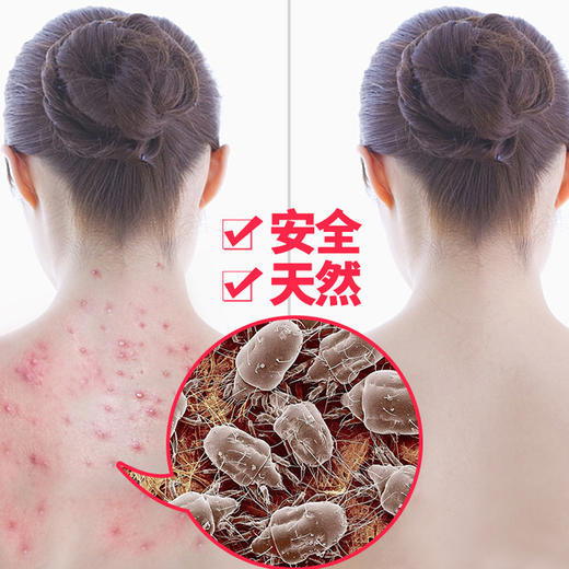 【进口产品】渔生堂日本正品除螨垫家用轻松除螨贴 商品图1