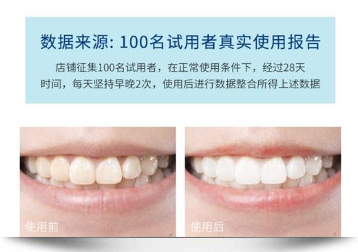 KJ 新美迪安93%去牙垢护理靓白牙膏120g 商品图1