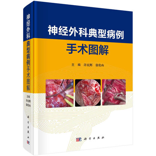 神经外科典型病例手术图解/许民辉 徐伦山 商品图0