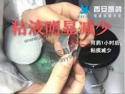 【祛痰灵】20ml/瓶 清除呼吸道粘痰、浓痰（西安凯鸽） 商品图2