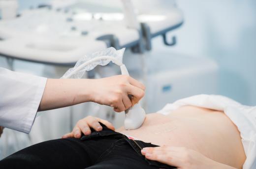 第10-13周产检 商品图0