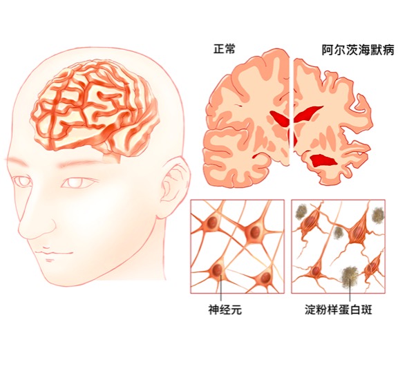 【焕活】香薰精油｜促进大脑恢复活力｜活化+镇静｜扩香使用｜香薰瓶