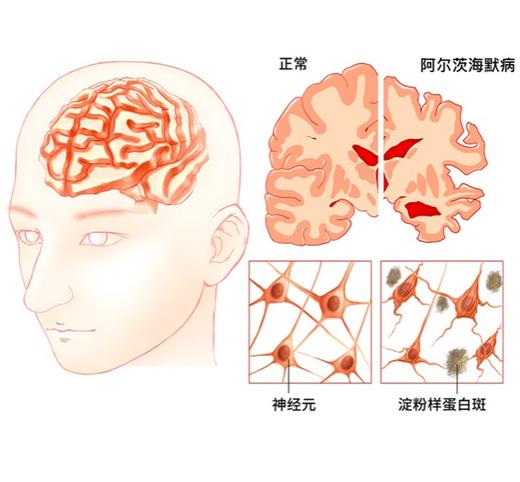 【焕活】香薰精油｜促进大脑恢复活力｜活化+镇静｜扩香使用｜香薰瓶 商品图0