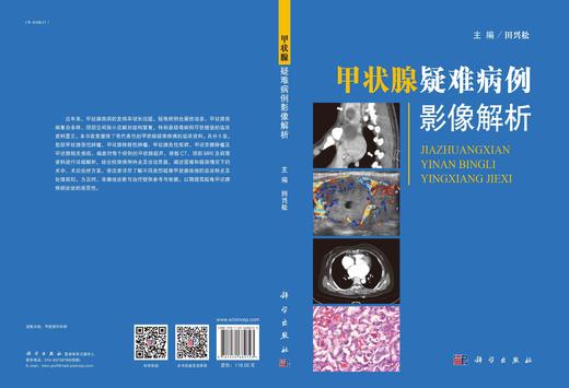 甲状腺疑难病例影像解析/田兴松 商品图3