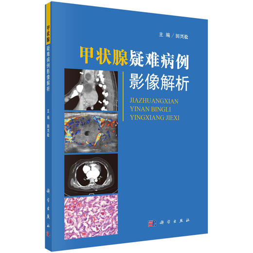 甲状腺疑难病例影像解析/田兴松 商品图0