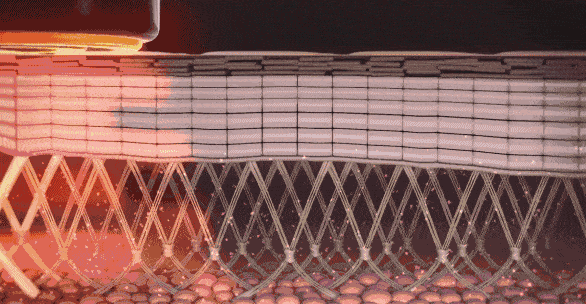 明星都推荐的抗衰项目热玛吉，香不香？