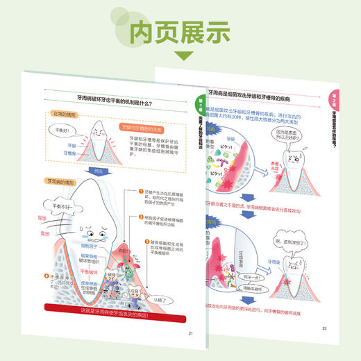 2020新书 家庭健康常识 牙周炎防治超图解 极爱家庭健康常识科普读物 牙齿常见疾病诊断治疗方法 牙周炎发病机制诊断治疗方法书籍 商品图4