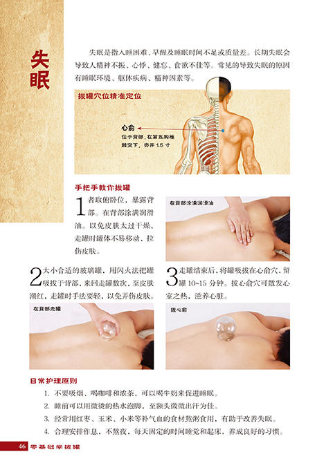零基础学拔罐 零基础学拔罐治百病 学拔罐的书 中医书籍 家庭保健养生图书拔罐工具书拔罐养生排毒大全 中医养生拔罐养生书籍 商品图2