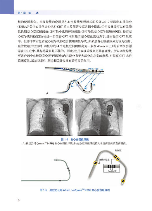正版 心脏再同步治疗随访与程控 陈柯萍 张澍 主编 内科学医学书籍 心律失常治疗临床案例 9787117301725人民卫生出版社 商品图3