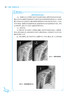 中医骨伤科学 第2版 全国中医住院医师规范化培训教材 詹红生 冷向阳 谭明生 主编 9787117312196人民卫生出版社 商品缩略图4