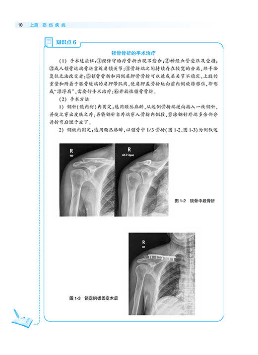 中医骨伤科学 第2版 全国中医住院医师规范化培训教材 詹红生 冷向阳 谭明生 主编 9787117312196人民卫生出版社 商品图4