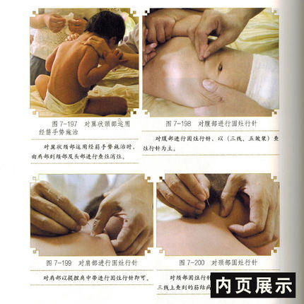 现货 经筋疗法（第三3版）黄艺 黄敬伟 著 中国中医药出版社 传承壮医诊病祛病精华疑难杂症一扫光实用全彩手法图示指导书籍 商品图4