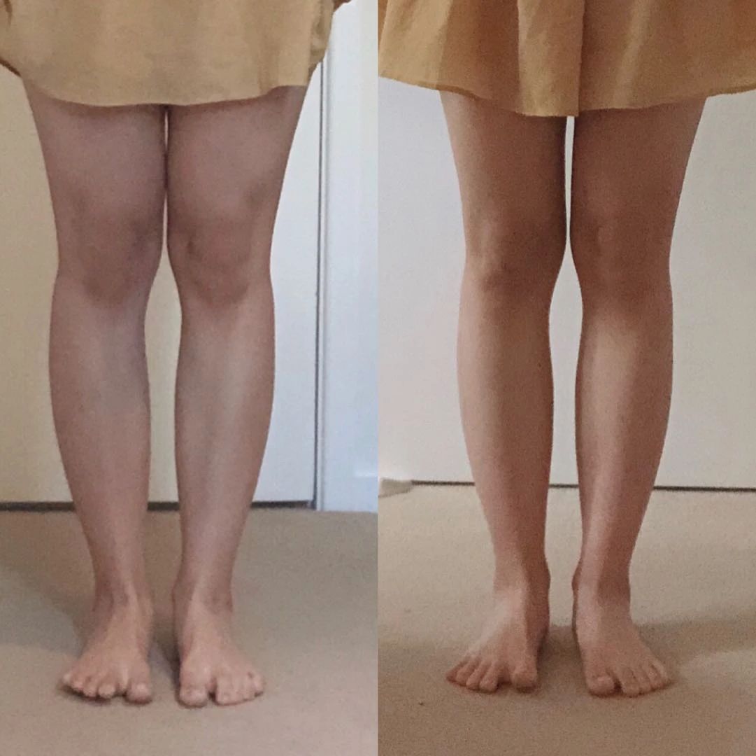 章小蕙同款 消肿纤腿 紧肤去橘皮 燃脂塑形全天瘦腿霜100ml legology