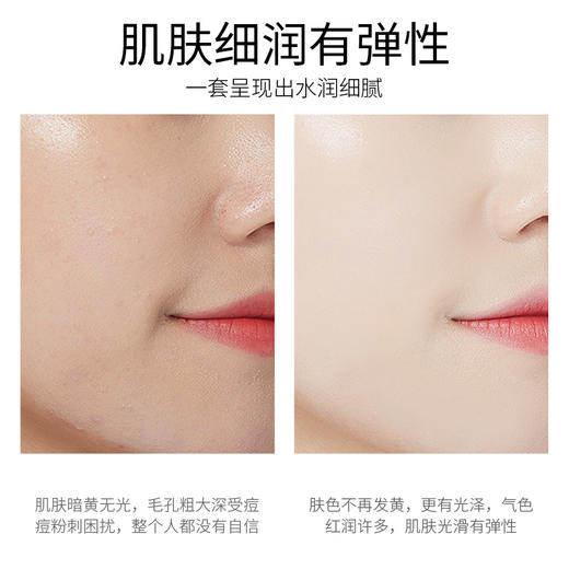 左香燕窝多肽蛋白肽水乳套装提亮肤色补水保湿水乳护肤品套装七夕情人节 商品图4