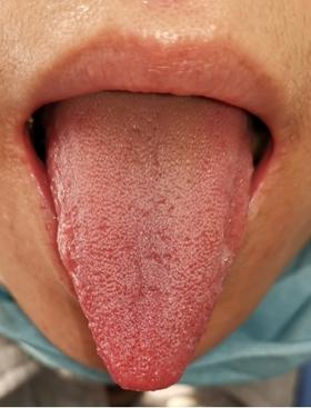 班长课堂093 | 过敏性哮喘医案一则