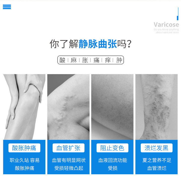 静脉曲张_02