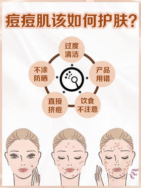 常年长痘的女孩子一定要看‼专治各种痘痘肌