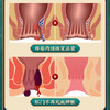 【买2送1，买3送2，买5送4】南京同仁堂痔疮灵老牌出品愈合痔疮裂口轻松5步解决保密发货 商品缩略图2