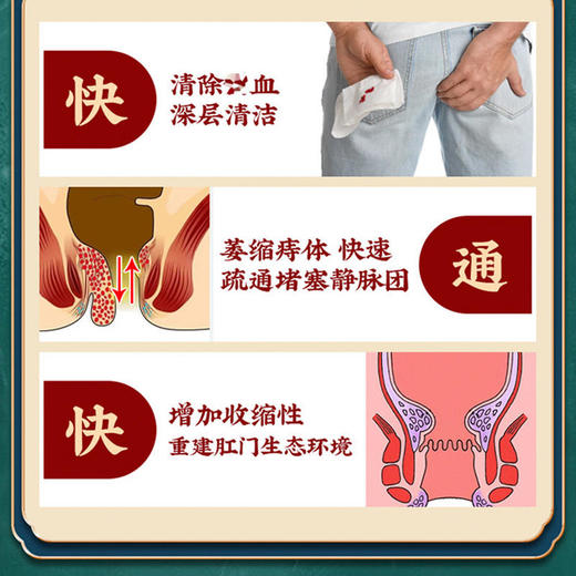 【买2送1，买3送2，买5送4】南京同仁堂痔疮灵老牌出品愈合痔疮裂口轻松5步解决保密发货 商品图3