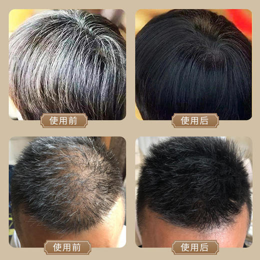 修正黑灵芝首乌洗发水中老年乌发男女老少都适用育发特证白发转黑防脱发护发让秀发自然乌黑浓密，拒绝染发 商品图2