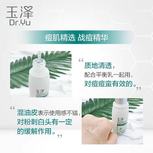 【玉泽】玉泽清痘精华液30ml新长小红痘、白头温和水杨酸不刺激 商品图3