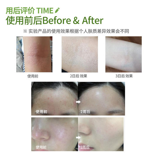 【氧丽可丝】氧丽可丝韩国正品ATO安心面霜镇静敏感肌肤专用保湿急救面霜20ml 商品图2