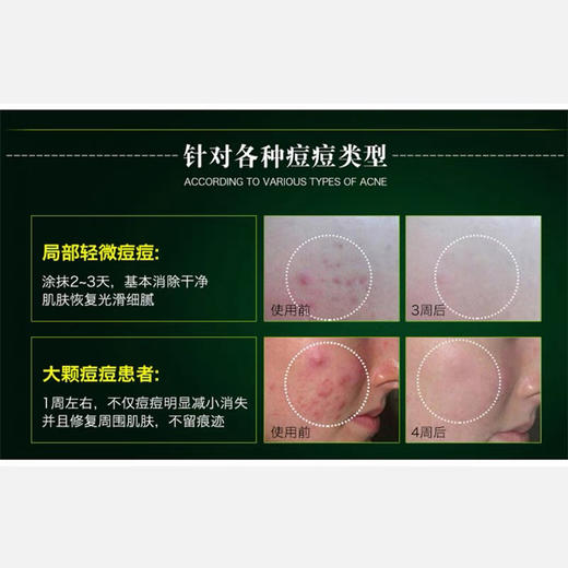 TBS茶树精油10ml 商品图4