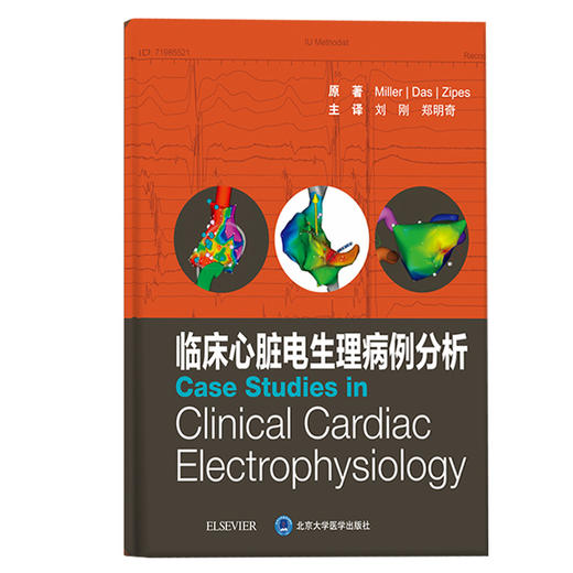 现货 临床心脏电生理病例分析 展示了复杂的消融术及既往手术失败的案例  刘刚 郑明奇 主译 9787565922824北京大学医学出版社 商品图2