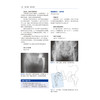 Corail®髋关节假体的设计原理和实战技巧 商品缩略图4