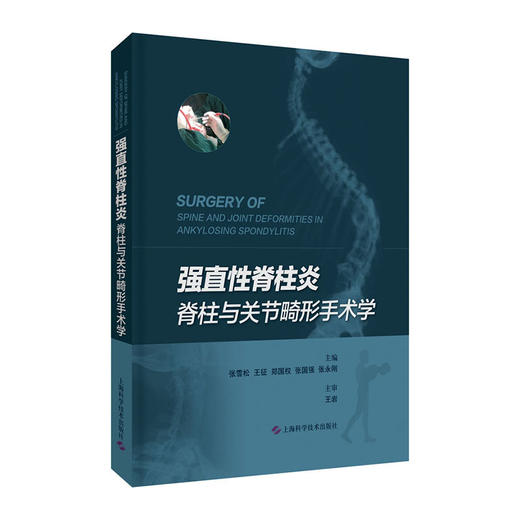 强直性脊柱炎脊柱与关节畸形手术学(精)/人民邮电出版社/[英]凯尔.缪9787547850008 商品图0