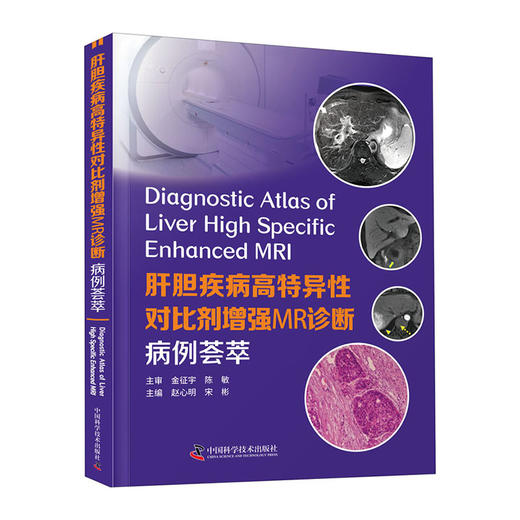 肝胆疾病高特异性对比剂增强MR诊断:病例荟萃(精)/中国科技出版社/常建民9787504688606 商品图0