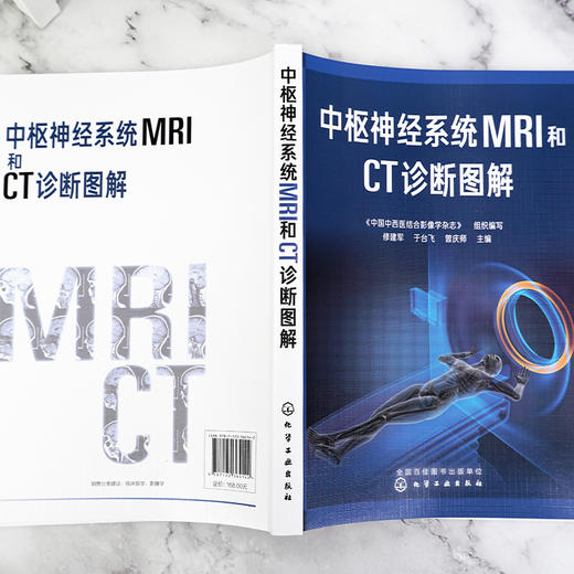 中1枢神经系统MRI和CT诊断图解 商品图4