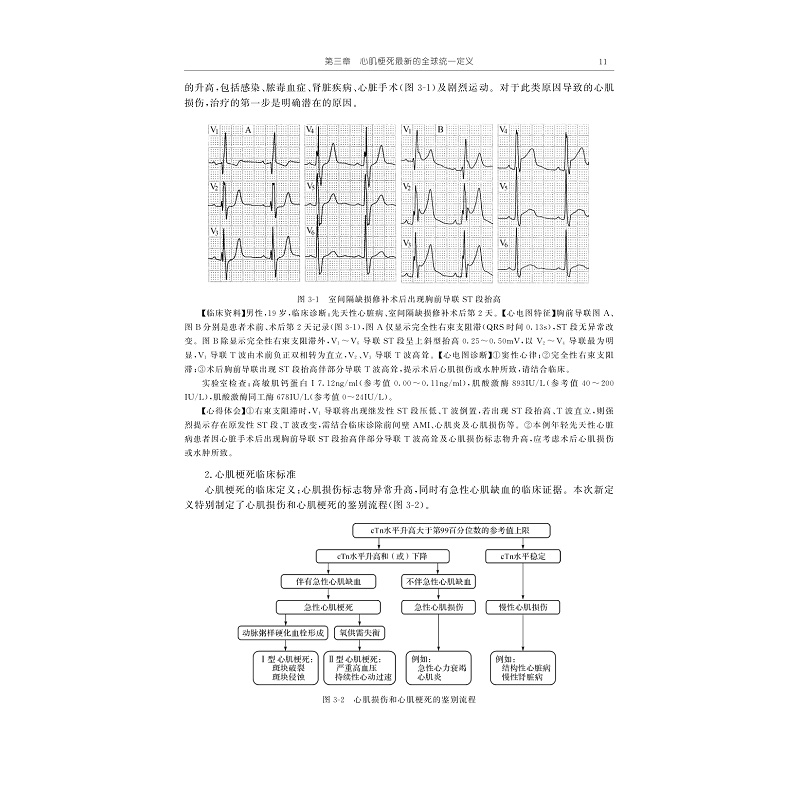 试读PDF-9787308211734(1-1)-危急重症心电图学_022.jpg
