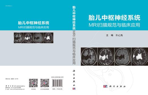 胎儿中枢神经系统MRI扫描规范与临床应用 商品图3