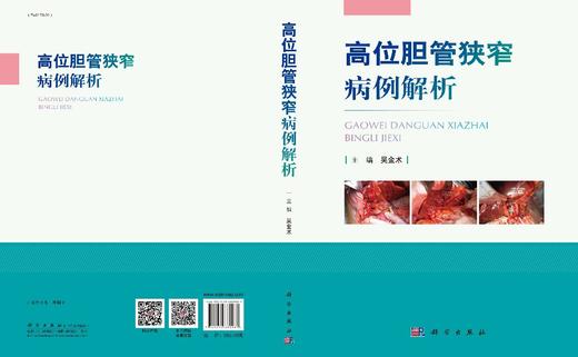 高位胆管狭窄病例解析/吴金术 商品图3