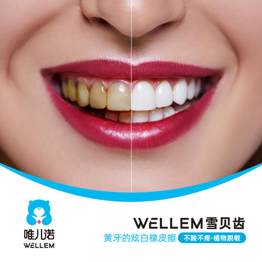 【齿科】皓得适 HiTeeth - 雪贝齿 美白健康爱牙套餐 商品图2