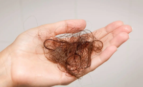  春暖花开，万物生“发”，白发，脱发，要百日防，千日养 