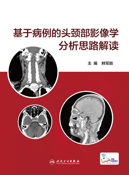 基于病例的头颈部影像学分析思路解读 商品图1