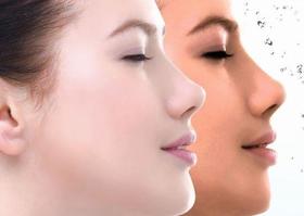  黄褐斑，你需要知道的都在这！ 