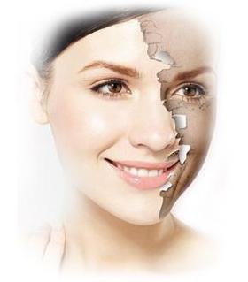  告别黄褐斑，做无“斑”女人！ 