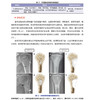 Oncologic Imaging :Bone Tumors （中文版） 商品缩略图2